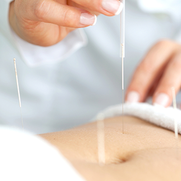 akupunktur i Haderslev, mave-tarmproblemer